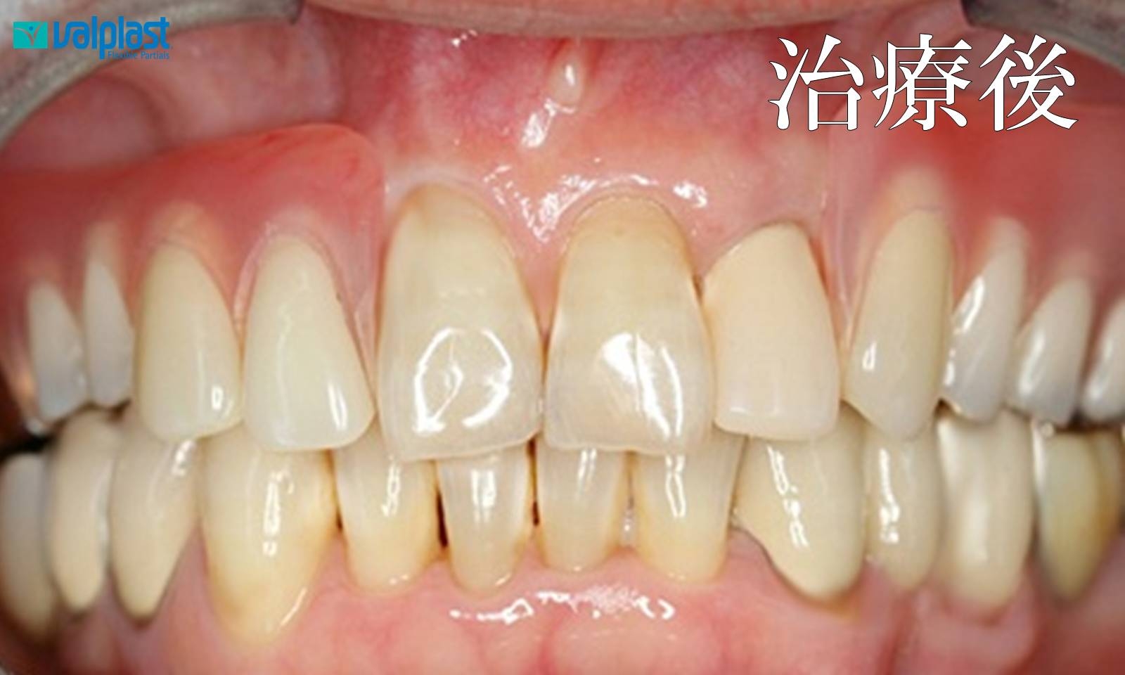 治療後